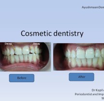 cosmetic-dentistry-1
